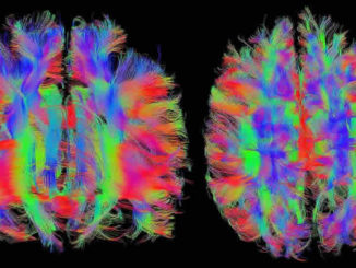 Gehirn-MRT-Kopf-brain
